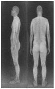 xray